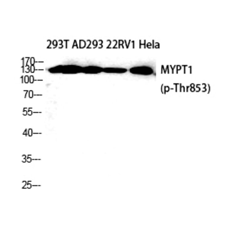 Western blot - MYPT1 (Phospho-Thr853) Polyclonal Antibody from Signalway Antibody (12302) - Antibodies.com