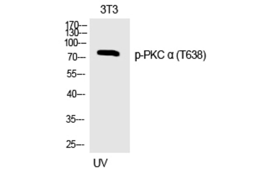 Western blot - PKC α (Phospho-Thr638) Polyclonal Antibody from Signalway Antibody (12317) - Antibodies.com