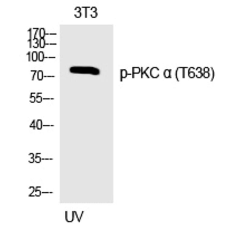 Western blot - PKC α (Phospho-Thr638) Polyclonal Antibody from Signalway Antibody (12317) - Antibodies.com
