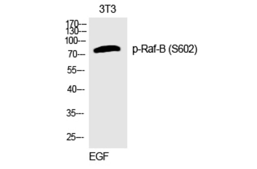 Western blot - Raf-B (Phospho-Ser602) Polyclonal Antibody from Signalway Antibody (12320) - Antibodies.com