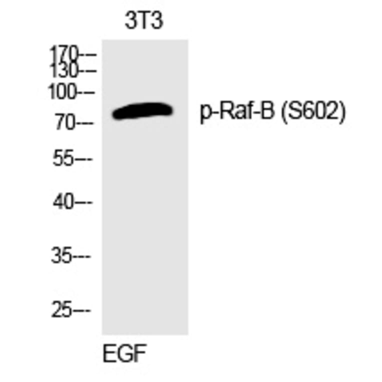 Western blot - Raf-B (Phospho-Ser602) Polyclonal Antibody from Signalway Antibody (12320) - Antibodies.com