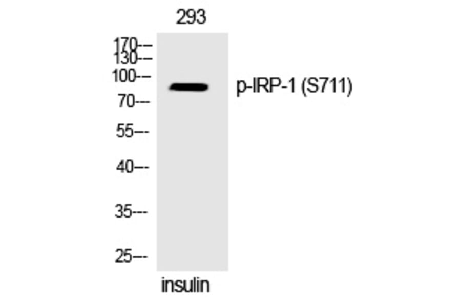 Western blot - IRP-1 (Phospho-Ser711) Polyclonal Antibody from Signalway Antibody (12329) - Antibodies.com