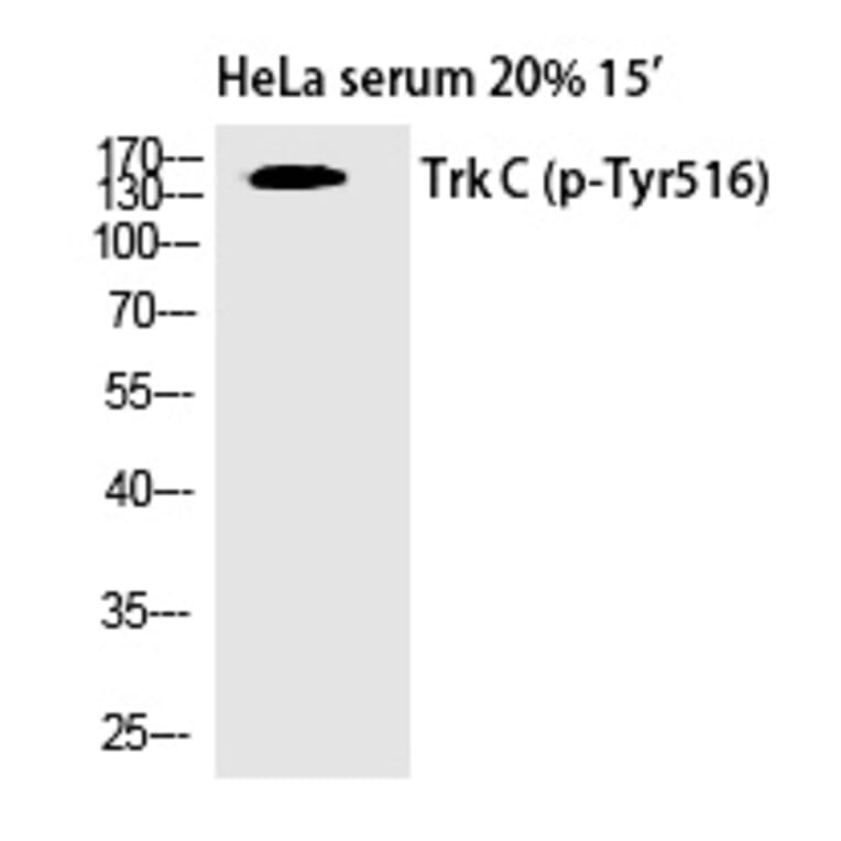 Western blot - Trk C (Phospho-Tyr516) Polyclonal Antibody from Signalway Antibody (12340) - Antibodies.com