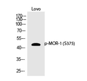 Western blot - MOR-1 (Phospho-Ser375) Polyclonal Antibody from Signalway Antibody (12370) - Antibodies.com