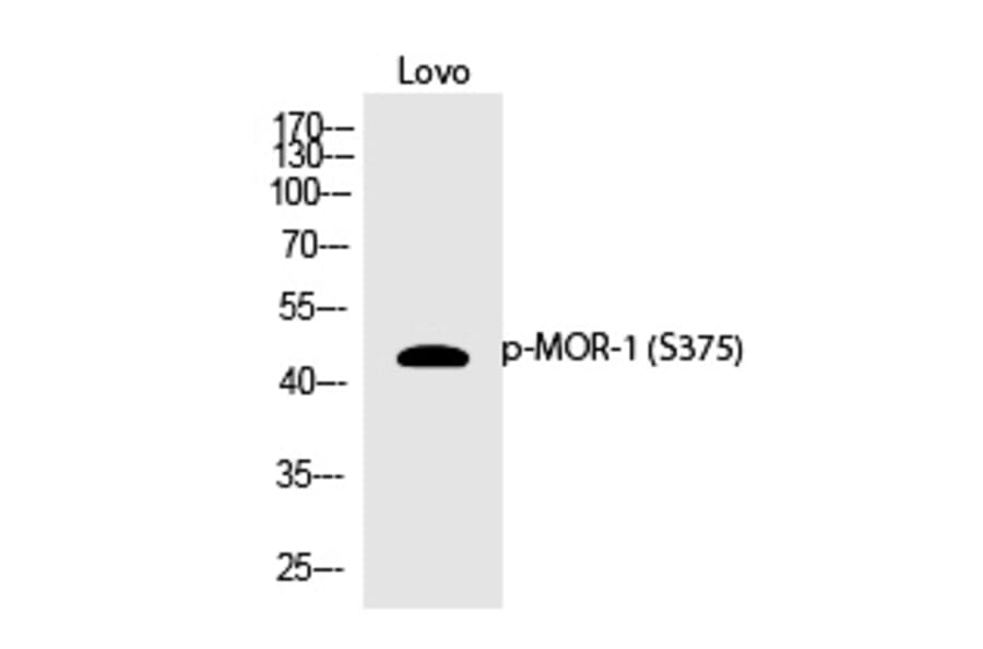 Western blot - MOR-1 (Phospho-Ser375) Polyclonal Antibody from Signalway Antibody (12370) - Antibodies.com
