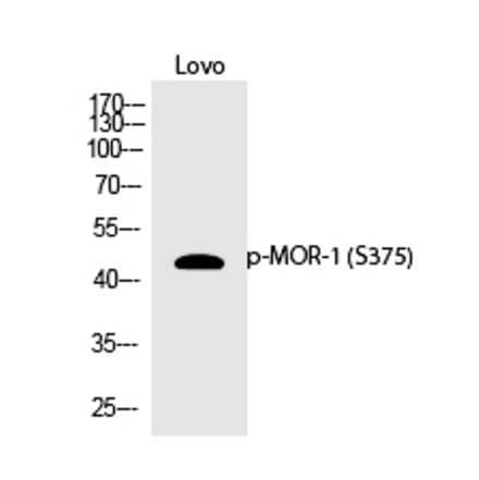Western blot - MOR-1 (Phospho-Ser375) Polyclonal Antibody from Signalway Antibody (12370) - Antibodies.com