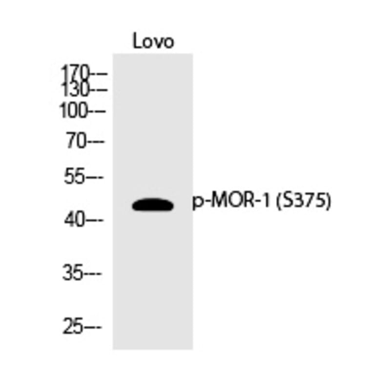 Western blot - MOR-1 (Phospho-Ser375) Polyclonal Antibody from Signalway Antibody (12370) - Antibodies.com