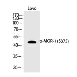 Western blot - MOR-1 (Phospho-Ser375) Polyclonal Antibody from Signalway Antibody (12370) - Antibodies.com