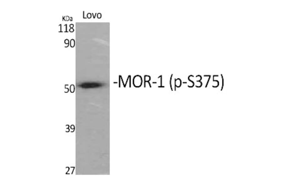 Western blot - MOR-1 (Phospho-Ser375) Polyclonal Antibody from Signalway Antibody (12370) - Antibodies.com