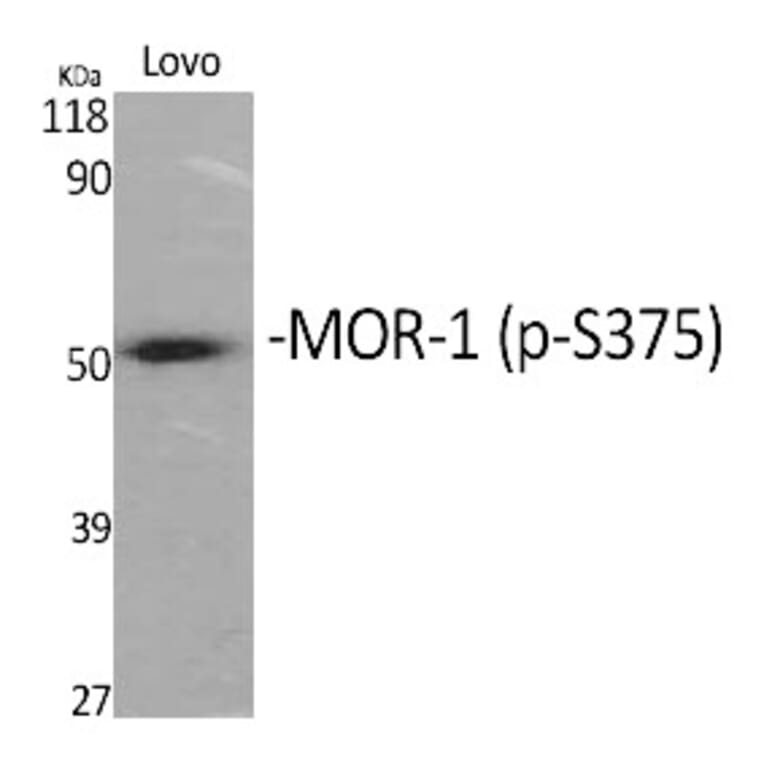 Western blot - MOR-1 (Phospho-Ser375) Polyclonal Antibody from Signalway Antibody (12370) - Antibodies.com