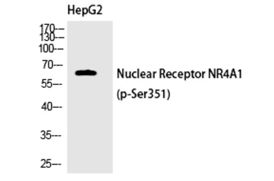 Western blot - Nur77 (Phospho-Ser351) Polyclonal Antibody from Signalway Antibody (12376) - Antibodies.com