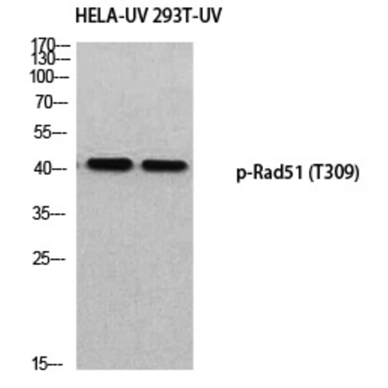 Western blot - Rad51 (Phospho-Thr309) Polyclonal Antibody from Signalway Antibody (12383) - Antibodies.com