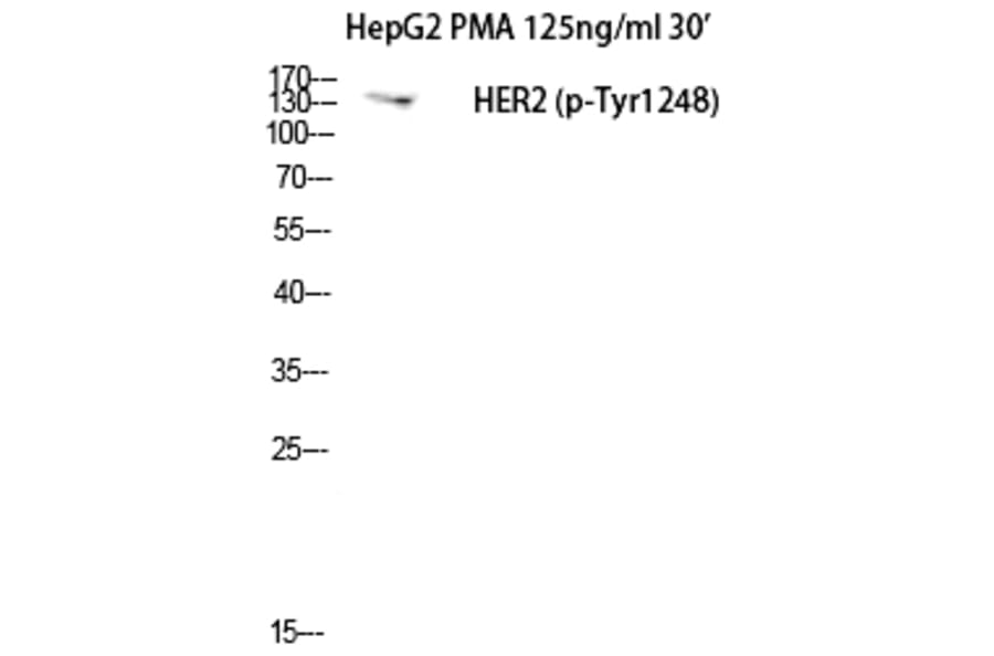 Western blot - Neu (Phospho-Tyr1248) Polyclonal Antibody from Signalway Antibody (12210) - Antibodies.com
