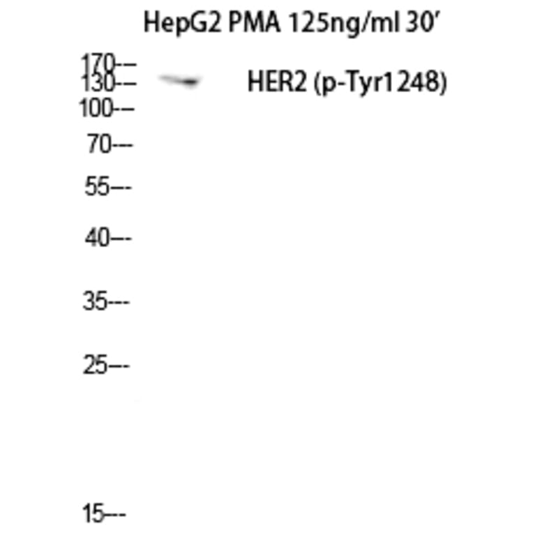 Western blot - Neu (Phospho-Tyr1248) Polyclonal Antibody from Signalway Antibody (12210) - Antibodies.com