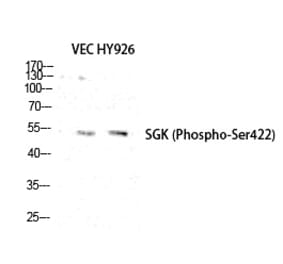 Western blot - SGK1 (Phospho-Ser422) Polyclonal Antibody from Signalway Antibody (12220) - Antibodies.com