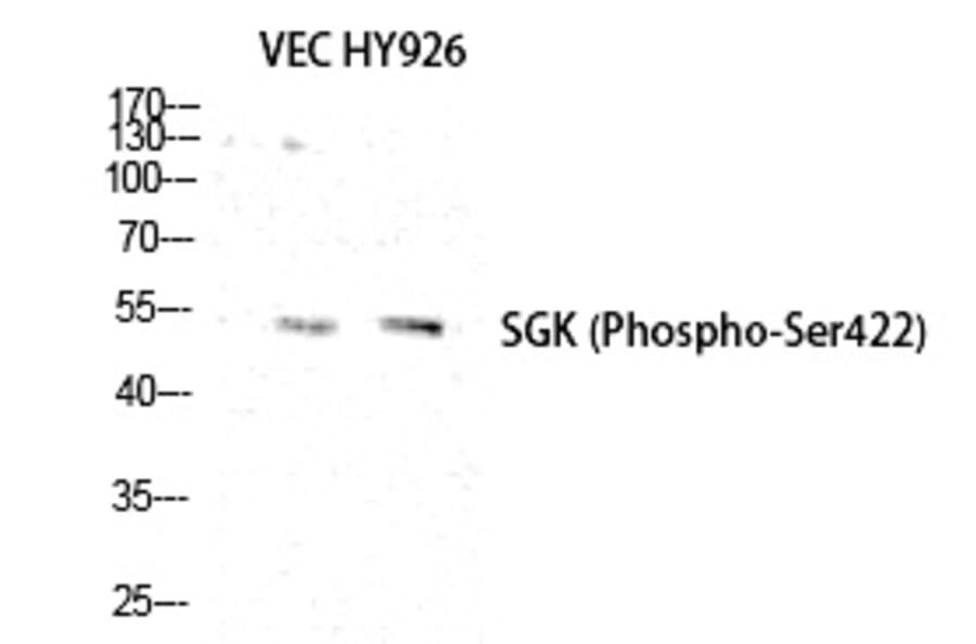 Western blot - SGK1 (Phospho-Ser422) Polyclonal Antibody from Signalway Antibody (12220) - Antibodies.com