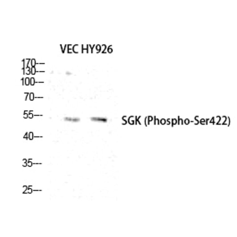 Western blot - SGK1 (Phospho-Ser422) Polyclonal Antibody from Signalway Antibody (12220) - Antibodies.com