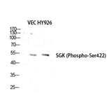 Western blot - SGK1 (Phospho-Ser422) Polyclonal Antibody from Signalway Antibody (12220) - Antibodies.com