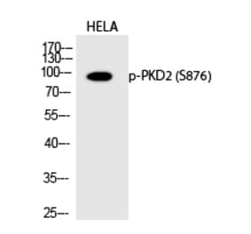 Western blot - PKD2 (Phospho-Ser876) Polyclonal Antibody from Signalway Antibody (12236) - Antibodies.com