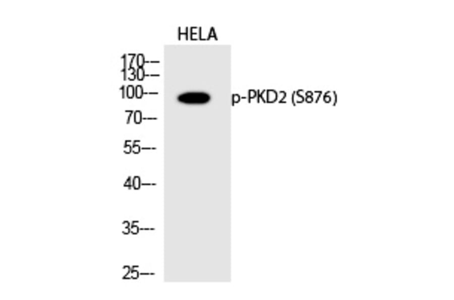 Western blot - PKD2 (Phospho-Ser876) Polyclonal Antibody from Signalway Antibody (12236) - Antibodies.com