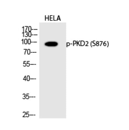 Western blot - PKD2 (Phospho-Ser876) Polyclonal Antibody from Signalway Antibody (12236) - Antibodies.com