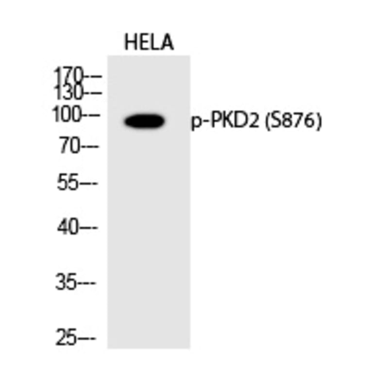 Western blot - PKD2 (Phospho-Ser876) Polyclonal Antibody from Signalway Antibody (12236) - Antibodies.com