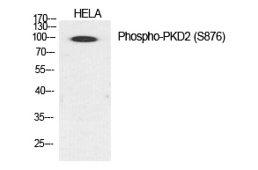 Western blot - PKD2 (Phospho-Ser876) Polyclonal Antibody from Signalway Antibody (12236) - Antibodies.com