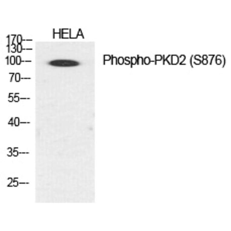 Western blot - PKD2 (Phospho-Ser876) Polyclonal Antibody from Signalway Antibody (12236) - Antibodies.com