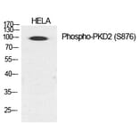 Western blot - PKD2 (Phospho-Ser876) Polyclonal Antibody from Signalway Antibody (12236) - Antibodies.com