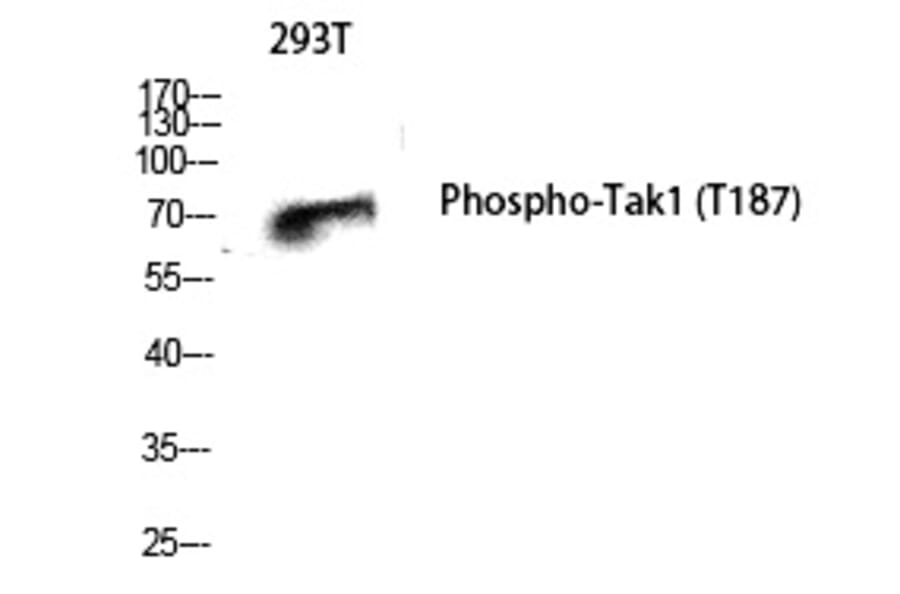 Western blot - Tak1 (Phospho-Thr187) Polyclonal Antibody from Signalway Antibody (12255) - Antibodies.com