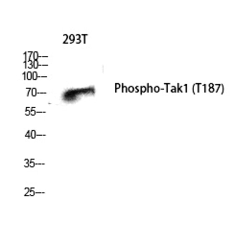 Western blot - Tak1 (Phospho-Thr187) Polyclonal Antibody from Signalway Antibody (12255) - Antibodies.com