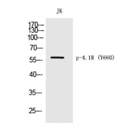 Western blot - 4.1R (Phospho-Tyr660) Polyclonal Antibody from Signalway Antibody (12262) - Antibodies.com