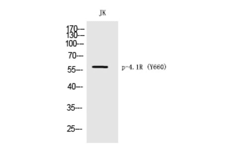 Western blot - 4.1R (Phospho-Tyr660) Polyclonal Antibody from Signalway Antibody (12262) - Antibodies.com