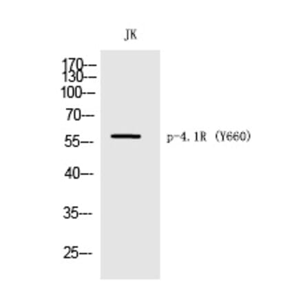 Western blot - 4.1R (Phospho-Tyr660) Polyclonal Antibody from Signalway Antibody (12262) - Antibodies.com