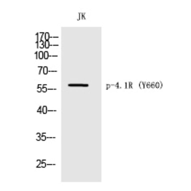 Western blot - 4.1R (Phospho-Tyr660) Polyclonal Antibody from Signalway Antibody (12262) - Antibodies.com