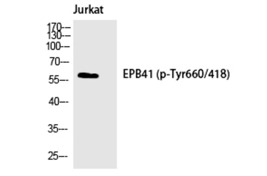 Western blot - 4.1R (Phospho-Tyr660) Polyclonal Antibody from Signalway Antibody (12262) - Antibodies.com