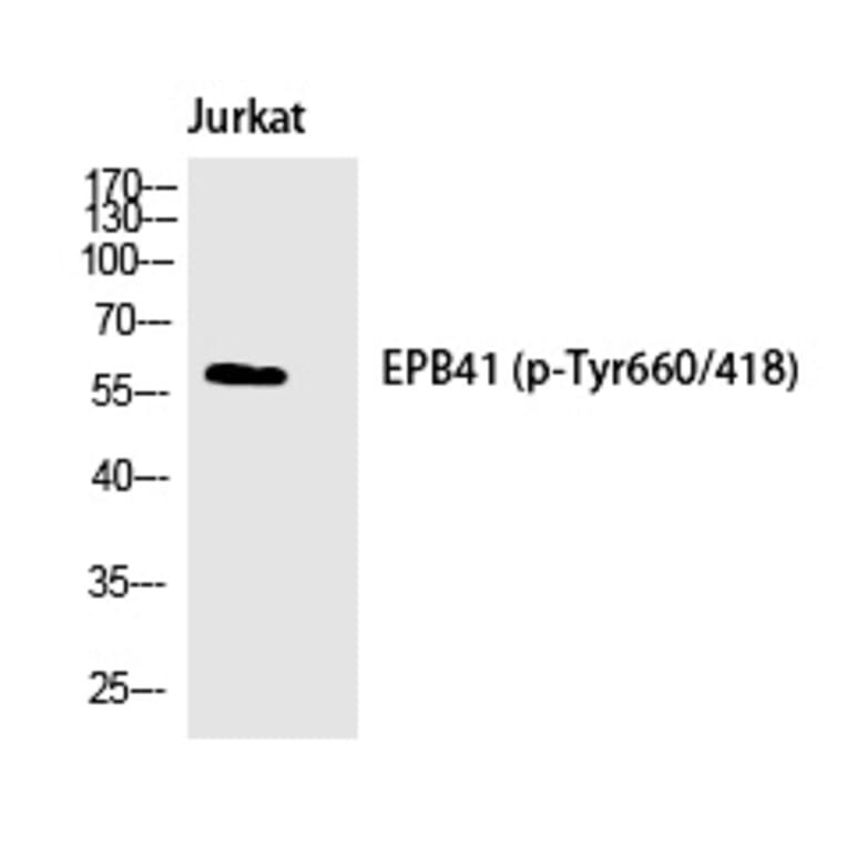 Western blot - 4.1R (Phospho-Tyr660) Polyclonal Antibody from Signalway Antibody (12262) - Antibodies.com