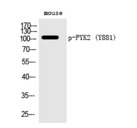 Western blot - PYK2 (Phospho-Tyr881) Polyclonal Antibody from Signalway Antibody (12291) - Antibodies.com