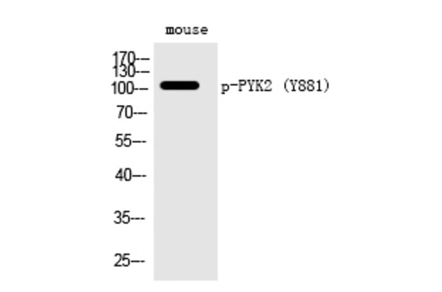 Western blot - PYK2 (Phospho-Tyr881) Polyclonal Antibody from Signalway Antibody (12291) - Antibodies.com