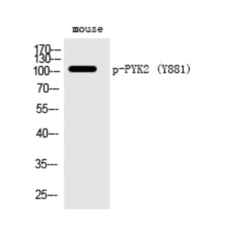 Western blot - PYK2 (Phospho-Tyr881) Polyclonal Antibody from Signalway Antibody (12291) - Antibodies.com