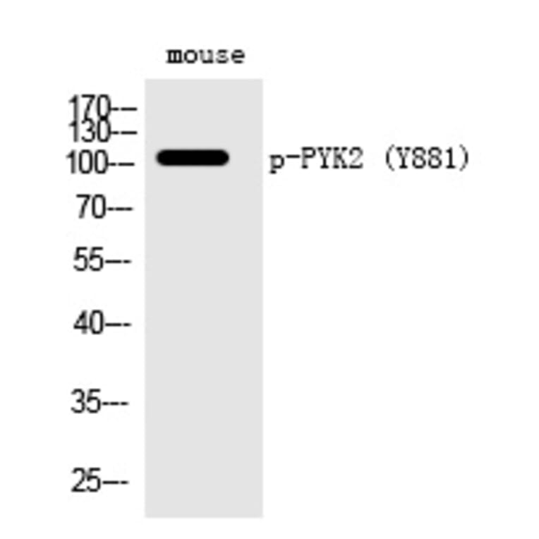 Western blot - PYK2 (Phospho-Tyr881) Polyclonal Antibody from Signalway Antibody (12291) - Antibodies.com