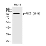 Western blot - PYK2 (Phospho-Tyr881) Polyclonal Antibody from Signalway Antibody (12291) - Antibodies.com