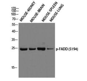 Western blot - FADD (Phospho-Ser194) Polyclonal Antibody from Signalway Antibody (12299) - Antibodies.com