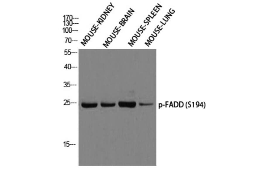 Western blot - FADD (Phospho-Ser194) Polyclonal Antibody from Signalway Antibody (12299) - Antibodies.com