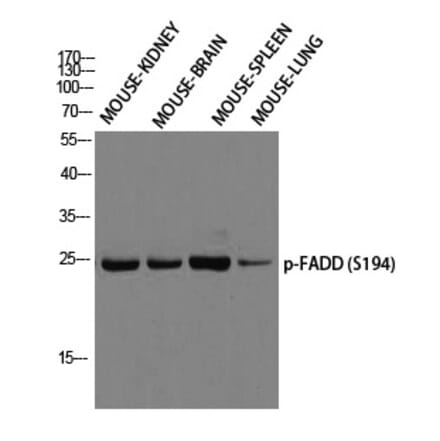 Western blot - FADD (Phospho-Ser194) Polyclonal Antibody from Signalway Antibody (12299) - Antibodies.com