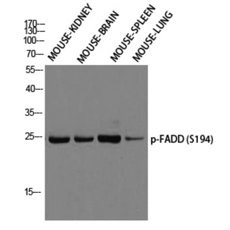 Western blot - FADD (Phospho-Ser194) Polyclonal Antibody from Signalway Antibody (12299) - Antibodies.com