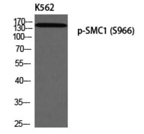 Western blot - SMC1 (Phospho-Ser966) Polyclonal Antibody from Signalway Antibody (12305) - Antibodies.com