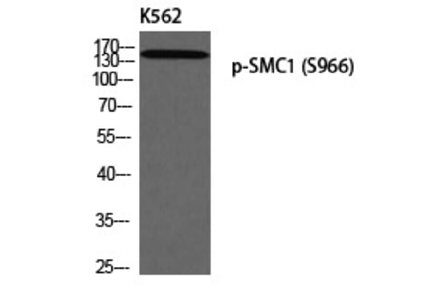 Western blot - SMC1 (Phospho-Ser966) Polyclonal Antibody from Signalway Antibody (12305) - Antibodies.com