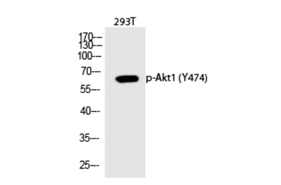 Western blot - Akt1 (Phospho-Tyr474) Polyclonal Antibody from Signalway Antibody (12311) - Antibodies.com
