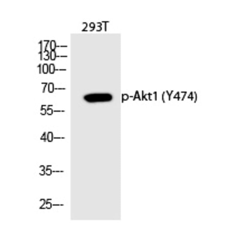 Western blot - Akt1 (Phospho-Tyr474) Polyclonal Antibody from Signalway Antibody (12311) - Antibodies.com